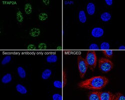 AP2 alpha Antibody (PSH02-06), Novus Biologicals 100 &mu;L | Buy Online | Novus Biologicals | Fisher Scientific