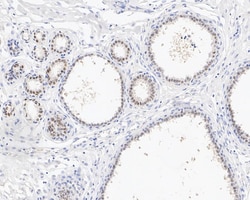 AP2 alpha Antibody (PSH02-06), Novus Biologicals 100 &mu;L | Buy Online | Novus Biologicals | Fisher Scientific