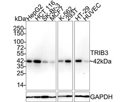 TRIB3 Antibody (PSH02-13), Novus Biologicals 100 &mu;L; Unconjugated:Antibodies,