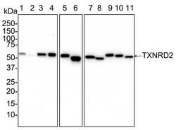 TXNRD2 Antibody (PSH02-26), Novus Biologicals 100 &mu;L; Unconjugated:Antibodies,