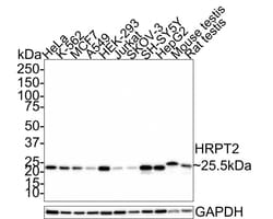 UBE2T Antibody (JE65-79), Novus Biologicals 100 &mu;L; Unconjugated:Antibodies,
