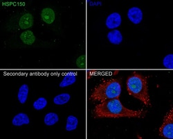 UBE2T Antibody (JE65-79), Novus Biologicals 100 &mu;L; Unconjugated:Antibodies,