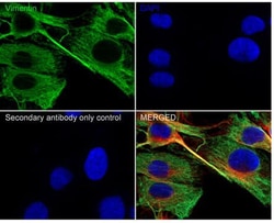 Vimentin Antibody (SC60-05), Novus Biologicals 100 &mu;L; Unconjugated:Antibodies,