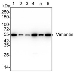 Vimentin Antibody (SC60-05), Novus Biologicals 100 &mu;L; Unconjugated:Antibodies,
