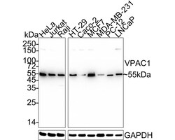 VIPR1/VPAC1 Antibody (PD00-96), Novus Biologicals 100 &mu;L; Unconjugated:Anticorps,