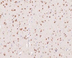 YTHD1 Antibody (PSH0-23), Novus Biologicals 100 &mu;L; Unconjugated:Antibodies,