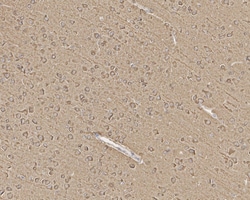 alpha Tubulin Antibody (PSH02-95), Novus Biologicals 100 &mu;L; Unconjugated:Antibodies,