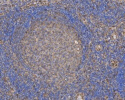 alpha Tubulin Antibody (PSH02-95), Novus Biologicals 100 &mu;L; Unconjugated:Antibodies,