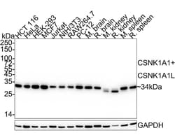 CSNK1A1/CSNK1A1L Antibody (PSH04-58), Novus Biologicals 100 &mu;L; Unconjugated:Antibodies,