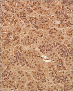 Pit1 Antibody, Novus Biologicals 0.1 mg; Unconjugated:Antibodies, Polyclonal