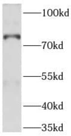 ABCD1 Antibody (9D11), Novus Biologicals 100 &mu;g; Unconjugated:Antibodies,