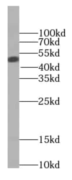 BCS1L Antibody (9G10), Novus Biologicals 100 &mu;g; Unconjugated:Antibodies,