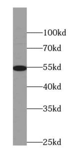 AEBP2 Antibody (9B3), Novus Biologicals 100 &mu;g; Unconjugated:Antikörper
