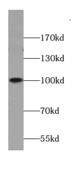 AKAP3 Antibody (0B8), Novus Biologicals 100 &mu;g; Unconjugated:Antibodies,