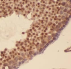 AKAP3 Antibody (0B8), Novus Biologicals 100 &mu;g; Unconjugated:Antibodies,