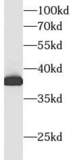 Aldolase C Antibody (6F3), Novus Biologicals 100 &mu;g; Unconjugated:Antibodies,