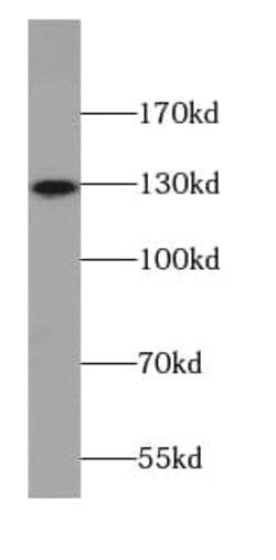 AMOT Antibody (2C9), Novus Biologicals 100 &mu;g; Unconjugated:Antibodies,