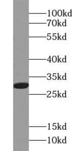 ANP32B Antibody (4F5), Novus Biologicals 100 &mu;g; Unconjugated:Antibodies,