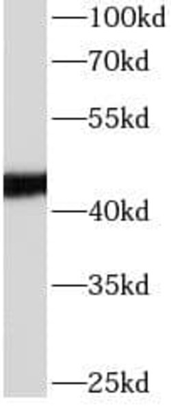 Apolipoprotein L1 Antibody (5E2), Novus Biologicals 100 &mu;g; Unconjugated:Antibodies,