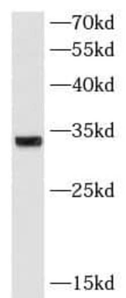 ATPG Antibody (8H11), Novus Biologicals 100 &mu;g; Unconjugated:Antibodies,