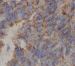 ATPG Antibody (8H11), Novus Biologicals 100 &mu;g; Unconjugated:Antibodies,