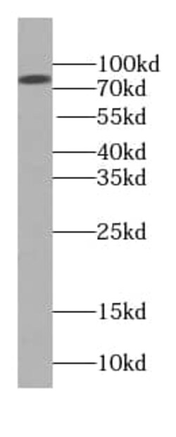 BBS2 Antibody (9F10), Novus Biologicals 100 &mu;g; Unconjugated:Antibodies,