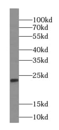 IMP3 Antibody (4D1), Novus Biologicals 100 &mu;g; Unconjugated:Antibodies,