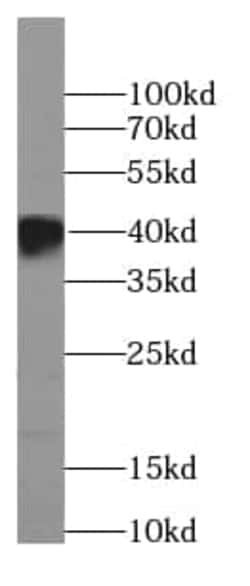 BBS5 Antibody (7E11), Novus Biologicals 100 &mu;g; Unconjugated:Antikörper