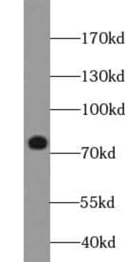 BORIS Antibody (2B10), Novus Biologicals 100 &mu;g; Unconjugated:Antibodies,