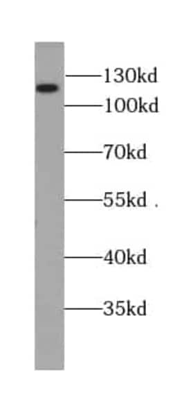 BRD8 Antibody (4B2), Novus Biologicals 100 &mu;g; Unconjugated:Anticuerpos