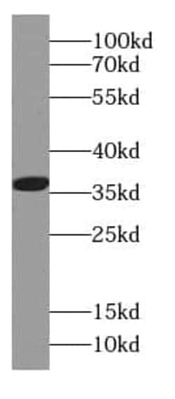 CAPZA1 Antibody (2C8), Novus Biologicals 100 &mu;g; Unconjugated:Antibodies,