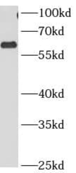 CCT3 Antibody (8C8), Novus Biologicals 100 &mu;g; Unconjugated:Antibodies,