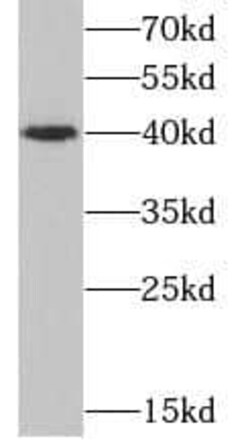 CD1d Antibody (1E3), Novus Biologicals 100 &mu;g; Unconjugated:Antibodies,