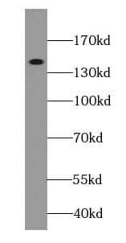 Ceruloplasmin Antibody (8F3), Novus Biologicals 100 &mu;g; Unconjugated:Antibodies,