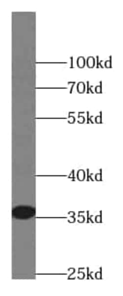SCGF/CLEC11a Antibody (8C9), Novus Biologicals 100 &mu;g; Unconjugated:Antibodies,