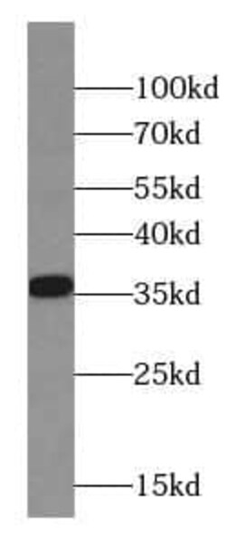 Calponin 2 Antibody (4C9), Novus Biologicals 100 &mu;g; Unconjugated:Antibodies,
