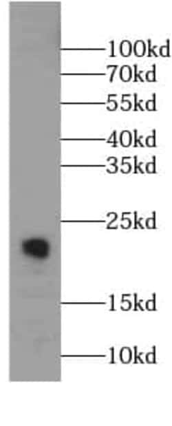 CNPY2 Antibody (8F6), Novus Biologicals 100 &mu;g; Unconjugated:Antibodies,