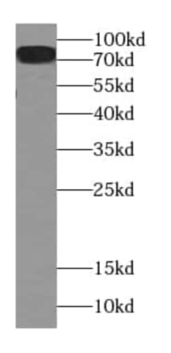 CPT1C Antibody (4E4), Novus Biologicals 100 &mu;g; Unconjugated:Antibodies,