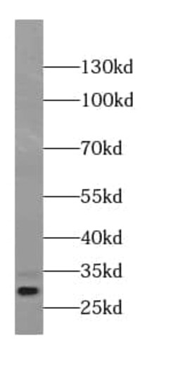 beta B1 Crystallin Antibody (2D8), Novus Biologicals 100 &mu;g; Unconjugated:Antibodies,