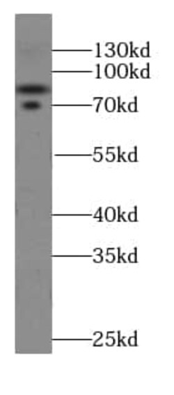 Cullin 4a Antibody (5A7), Novus Biologicals 100 &mu;g; Unconjugated:Antibodies,
