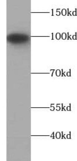 Isopeptidase T/USP5 Antibody (6G1), Novus Biologicals 100 &mu;g; Unconjugated:Antibodies,