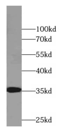 CYB5R3 Antibody (8H0), Novus Biologicals 100 &mu;g; Unconjugated:Antibodies,