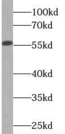 Cytochrome P450 2D6 Antibody (2C1), Novus Biologicals 100 &mu;g; Unconjugated:Antibodies,