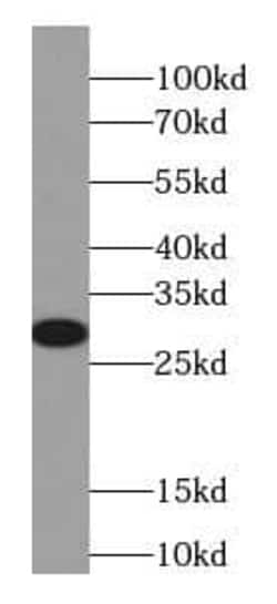 Cytoglobin Antibody (7F6), Novus Biologicals 100 &mu;g; Unconjugated:Antibodies,