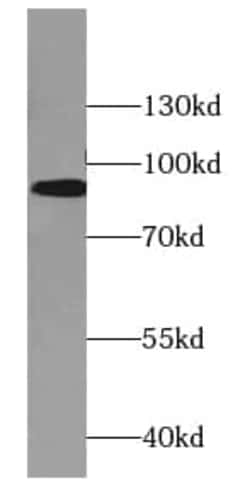 DBC1 Antibody (8C10), Novus Biologicals 100 &mu;g; Unconjugated:Antibodies,