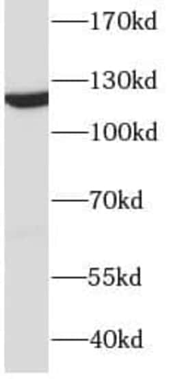 DDB1 Antibody (3A0), Novus Biologicals 100 &mu;g; Unconjugated:Antikörper