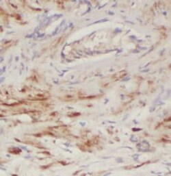 ECHS1 Antibody (1H0), Novus Biologicals 100 &mu;g; Unconjugated:Antibodies,
