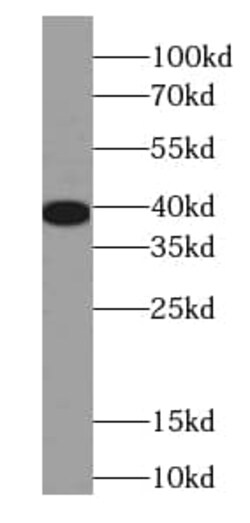 EEF1D Antibody (6D9), Novus Biologicals 100 &mu;g; Unconjugated:Antibodies,