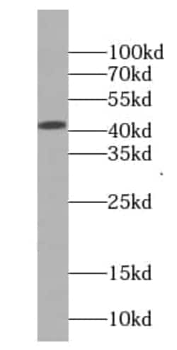 EIF3M Antibody (1A4), Novus Biologicals 100 &mu;g | Buy Online | Novus Biologicals | Fisher Scientific