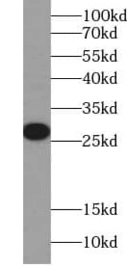 17 beta-HSD14/HSD17B14 Antibody (6C4), Novus Biologicals 100 &mu;g; Unconjugated:Antibodies,